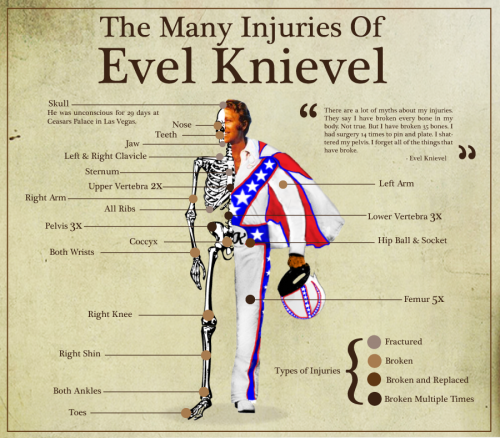 Evel Knievel's bones
